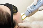 KAYA UNVEILS KAYA ULTIMA LASER HAIR REMOVAL IN UAE; SETS BENCHMARK WITH NEW TECHNOLOGY